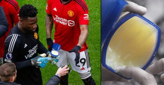 André Onana a t-il utilisé de la vaseline sur ses gants face à Liverpool ?